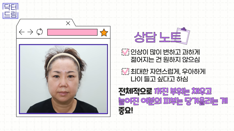 [강남꿈꾸는성형외과] 드림쌤 '중년 여성 성형' 상담 노트! 사진 5