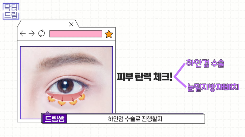 [강남꿈꾸는성형외과] 드림쌤 '중년 여성 성형' 상담 노트! 사진 13