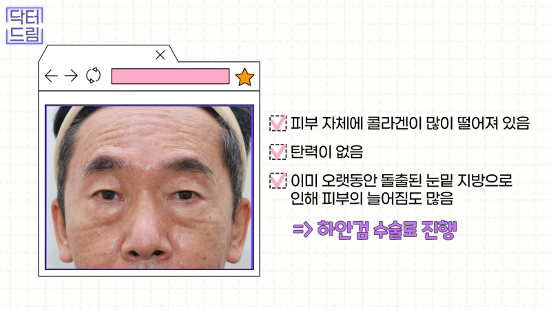 [강남꿈꾸는성형외과] 드림쌤 '중년 여성 성형' 상담 노트! 사진 14
