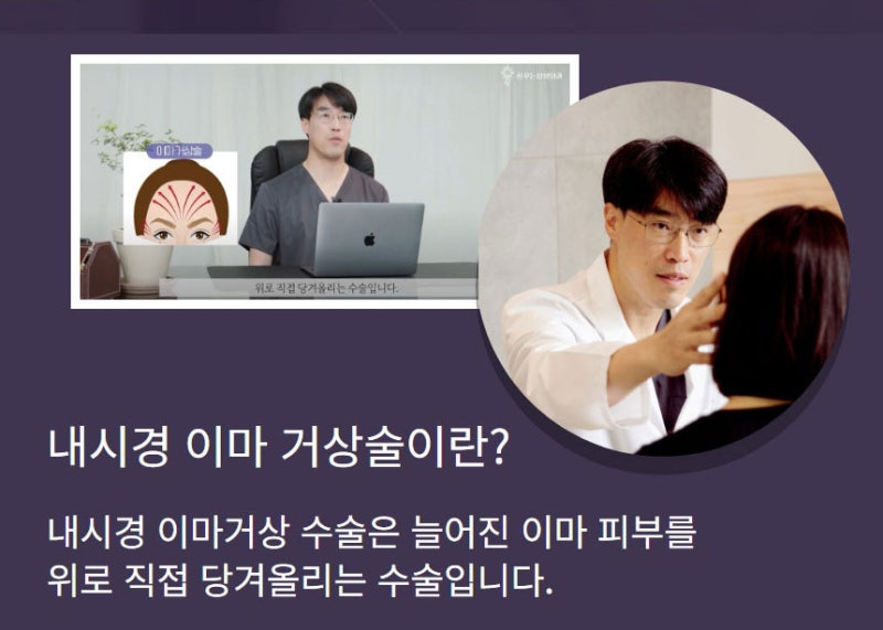 내시경이마거상 확실한 동안 비법