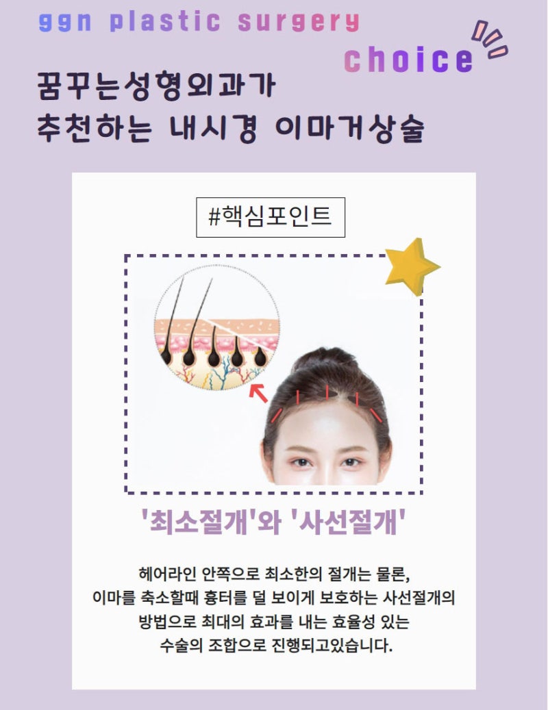 내시경이마거상 확실한 동안 비법 사진 6