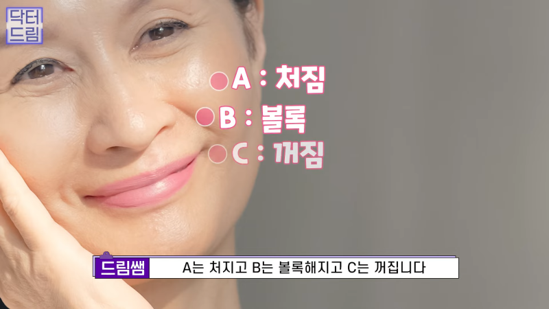 [강남꿈꾸는성형외과] 노화의 시작! 팔자주름 파헤치기 사진 7