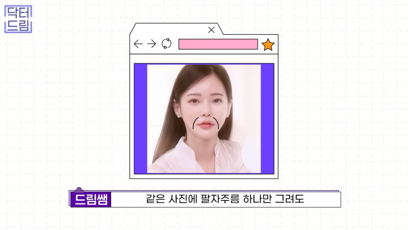 [강남꿈꾸는성형외과] 노화의 시작! 팔자주름 파헤치기 사진 3
