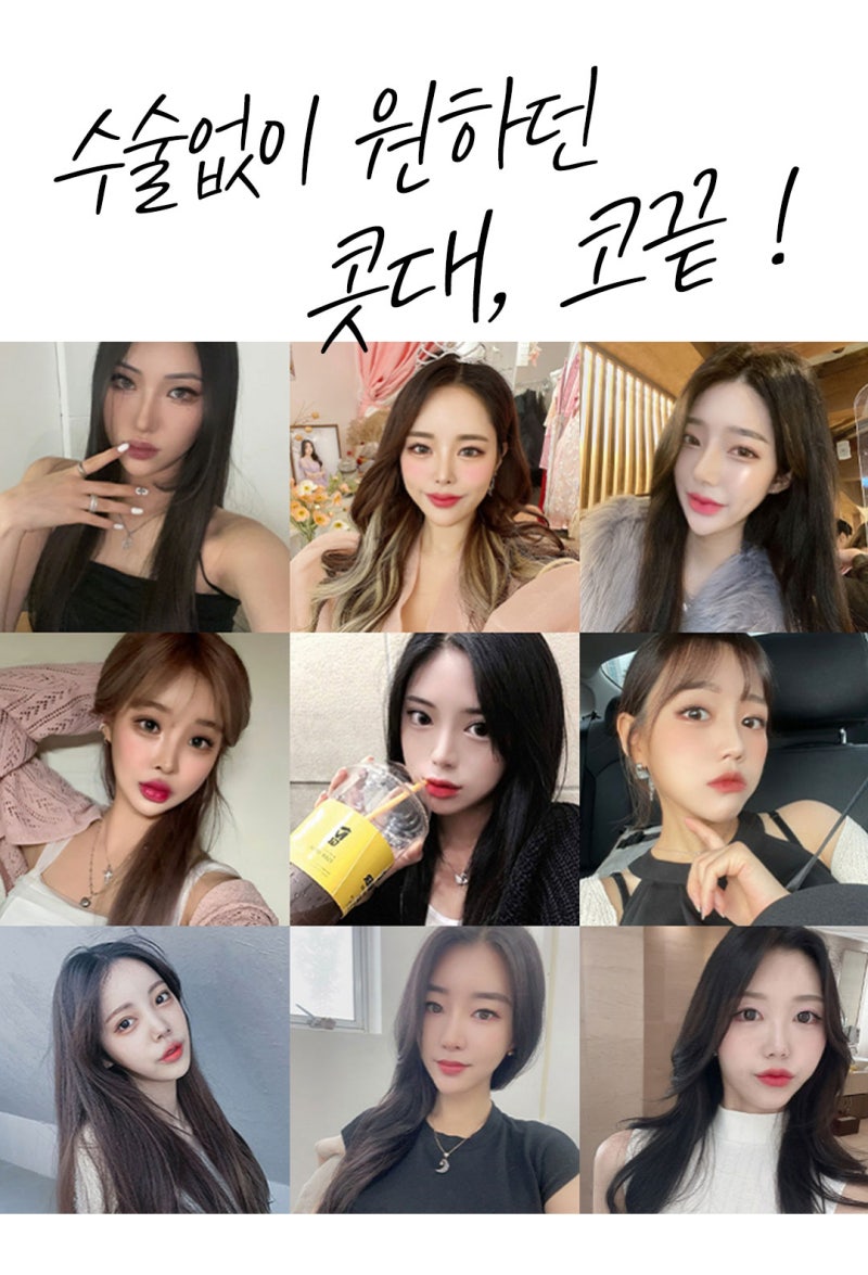 코필러 이벤트 6만원-눈에 띄는 모양으로 -꿈꾸는성형외과 사진 5