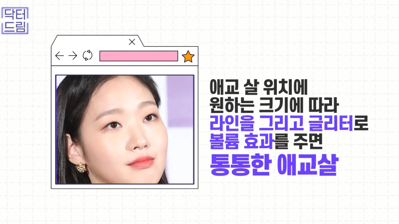 [강남꿈꾸는성형외과] 눈! 트임에 관한 모든 것!! 사진 7
