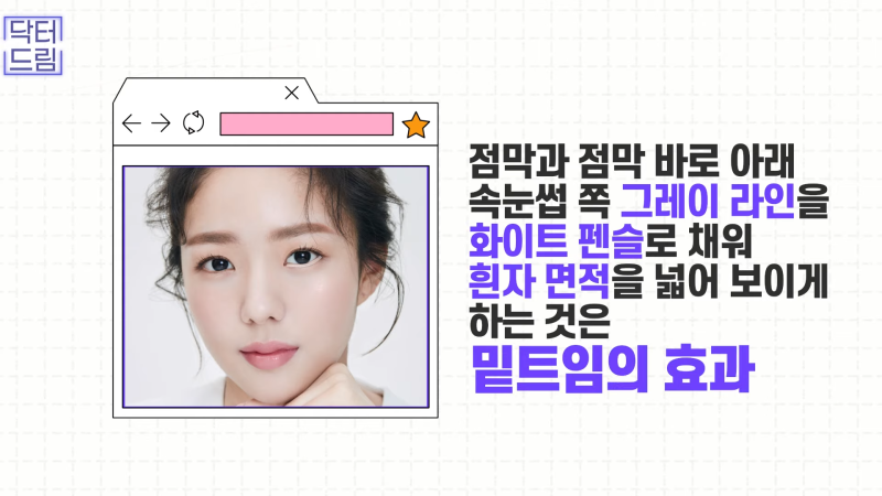 [강남꿈꾸는성형외과] 눈! 트임에 관한 모든 것!! 사진 5