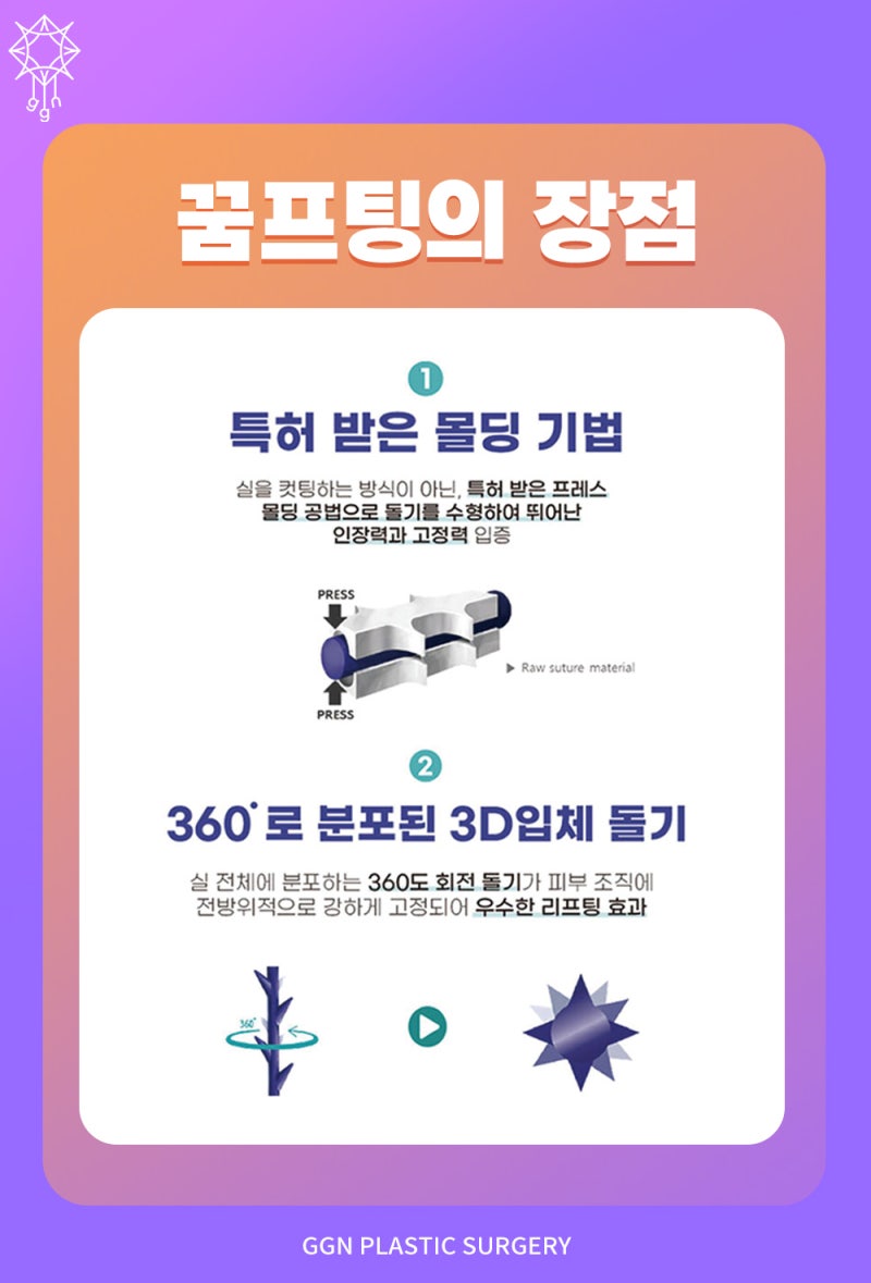 민트실리프팅 마리오네트 주름까지 -꿈꾸는성형외과 사진 4