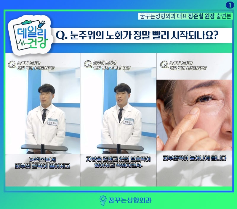 상안검 하안검 Q&A -데일리건강 꿈꾸는성형외과 장준철 원장님 방송출연분(1)