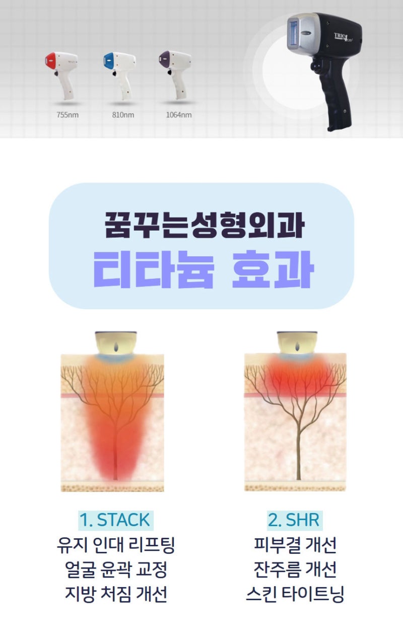 티타늄리프팅 시술 효과 확실하게 사진 8