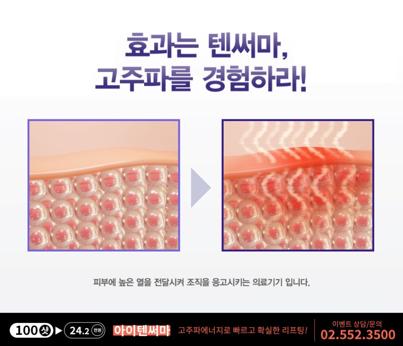 강남 아이텐써마 환해지는 효과기대해