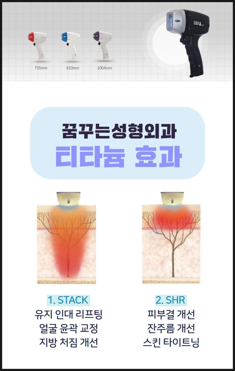 티타늄리프팅 레이저 통증 줄인 확실한 효과 사진 4