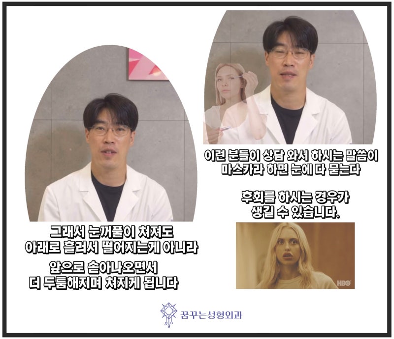 이마리프팅/이마거상-쌍꺼풀을 하면 안되는 유형은?[꿈꾸는성형외과]