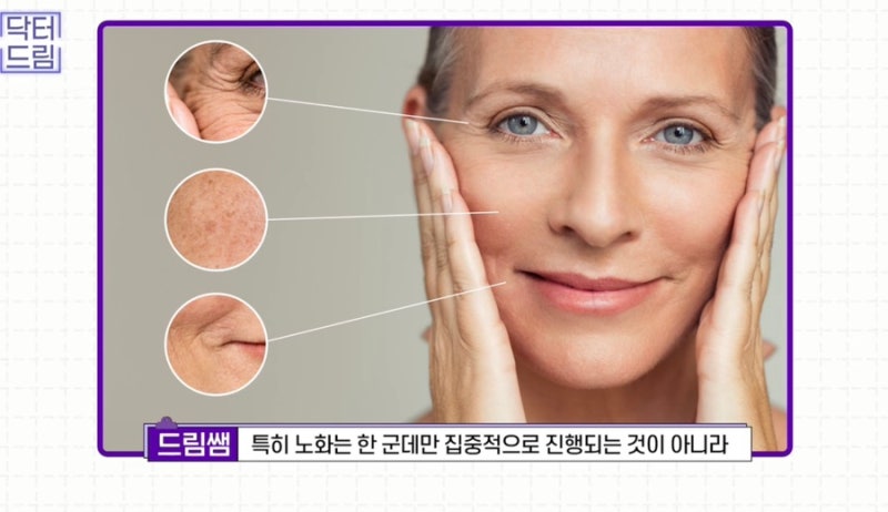 [강남꿈꾸는성형외과] 찰떡궁합! 함께하면 좋은 성형수술 사진 3