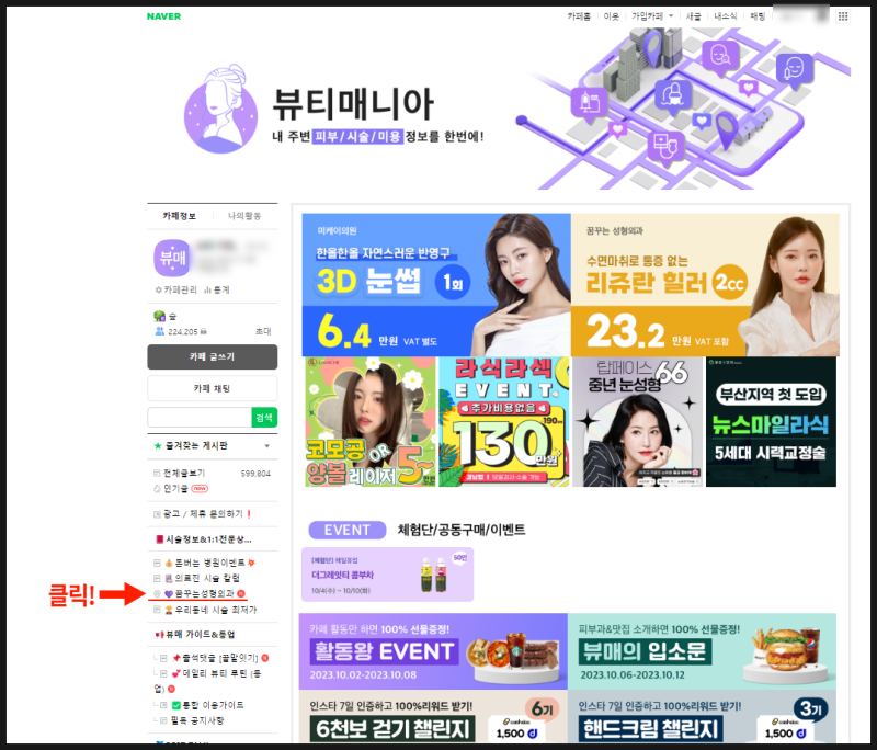 2023 최신 얼굴 성형 트렌드 사진 6