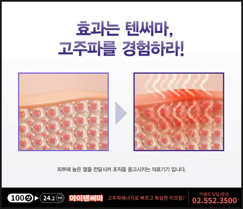강남 집중적으로 텐써마 리프팅 효과