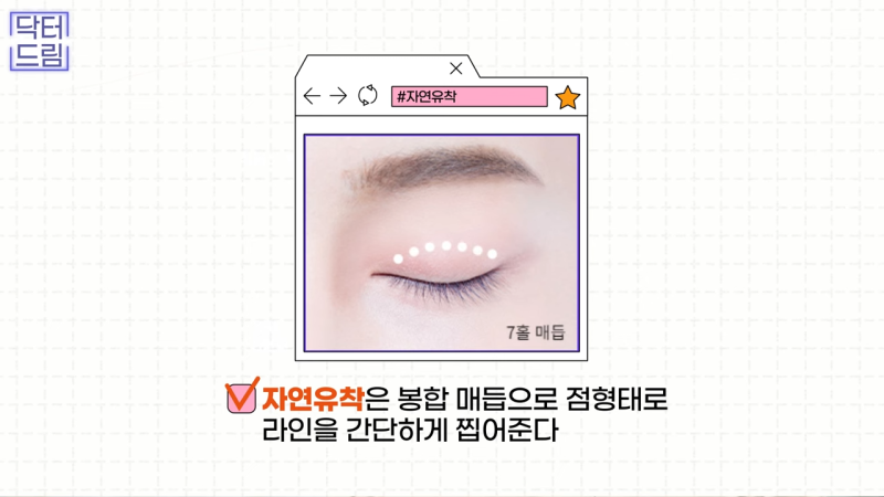 [강남꿈꾸는성형외과] 쌍수? 상안검? 내게 딱 맞는 눈 수술법 바로 알기! 사진 9
