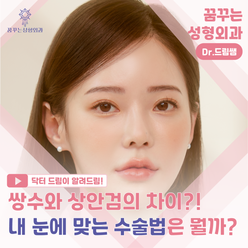 [강남꿈꾸는성형외과] 쌍수? 상안검? 내게 딱 맞는 눈 수술법 바로 알기!