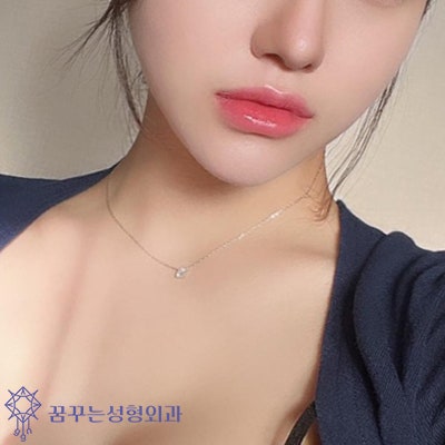 이마 실리프팅-얼굴비율의 변화로 사진 6