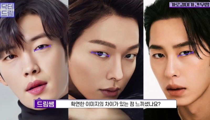 [강남꿈꾸는성형외과] 연예인으로 보는 2023 남자 눈 성형 트렌드 사진 9