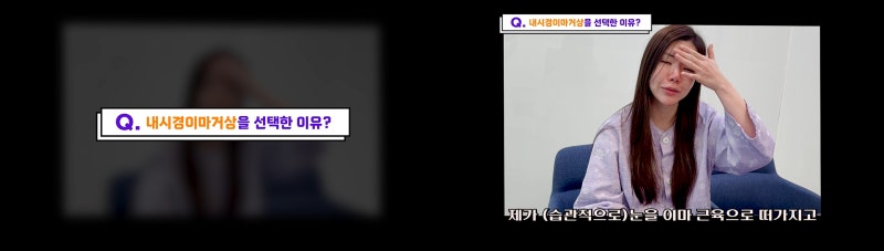 내시경이마거상 동안되는 비결 - 꿈꾸는성형외과 사진 2