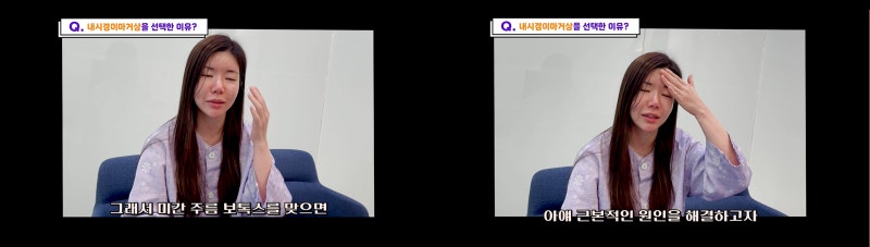 내시경이마거상 동안되는 비결 - 꿈꾸는성형외과 사진 4