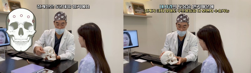 내시경이마거상 동안되는 비결 - 꿈꾸는성형외과 사진 11
