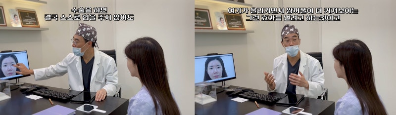 내시경이마거상 동안되는 비결 - 꿈꾸는성형외과 사진 10