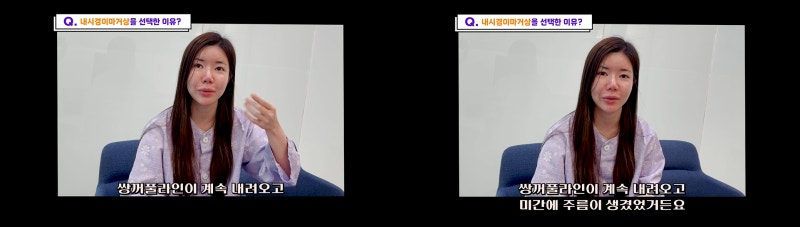 내시경이마거상 동안되는 비결 - 꿈꾸는성형외과 사진 3