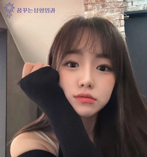 리쥬란힐러는 왜 피부에 좋을까?