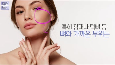 2023결산_ 가장 인기많은 핫한 레이저는? 사진 21