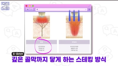 2023결산_ 가장 인기많은 핫한 레이저는? 사진 20