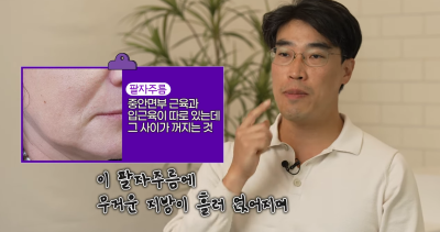팔자주름 마리오네트주름 입가주름 해결법 사진 10