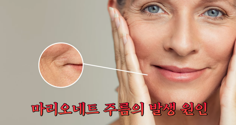 팔자주름 마리오네트주름 입가주름 해결법 사진 4