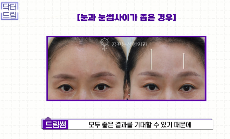 성형외과 의사가 알려주는 면접 팁, 소개팅, 인터뷰, 이미지메이킹 성공전략 사진 29