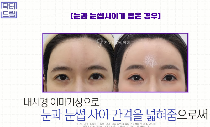 성형외과 의사가 알려주는 면접 팁, 소개팅, 인터뷰, 이미지메이킹 성공전략 사진 28