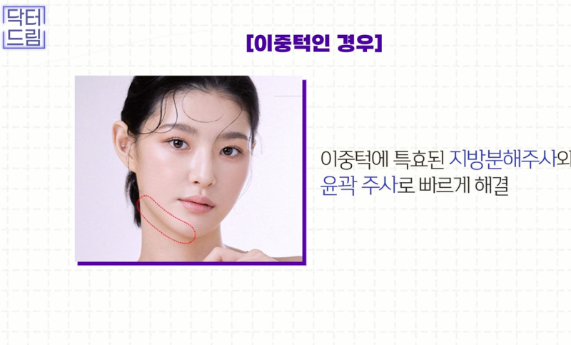 성형외과 의사가 알려주는 면접 팁, 소개팅, 인터뷰, 이미지메이킹 성공전략 사진 24