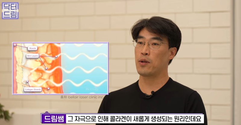 실리프팅 해 본 사람만 알 수 있는 비밀 사진 22