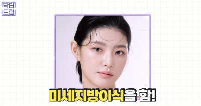 눈꺼풀이 쑥 꺼지고 퀭한 눈위꺼짐 해결법 (지방이식,필러) 사진 12