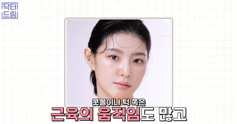 [강남역 성형외과] 켈로이드라서 쌍꺼풀 수술 고민하고 있다면 보세요. 흉터에 관한 모든걸 알려드려요 사진 7