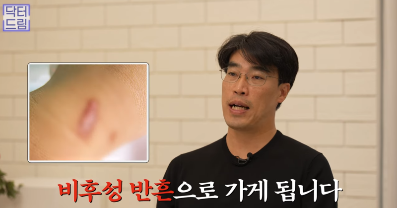 [강남역 성형외과] 켈로이드라서 쌍꺼풀 수술 고민하고 있다면 보세요. 흉터에 관한 모든걸 알려드려요 사진 16