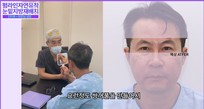 50대 중년 남자 노화고민 / 안티에이징 수술 솔직후기 사진 8