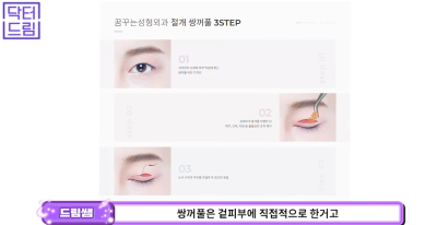 성형외과 의사의 양심고백/ 강남역 성형외과 고를 때 가장 중요한 점 사진 16