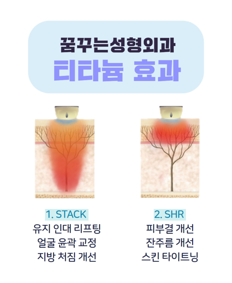 티타늄 리프팅 빛나는 탄력피부✨ 사진 2