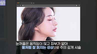 [강남역 성형외과] 이거 모르면 보톡스, 필러 맞았다가 후회합니다 사진 37