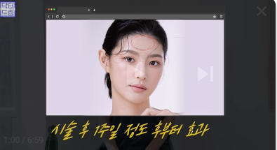 [강남역 성형외과] 이거 모르면 보톡스, 필러 맞았다가 후회합니다 사진 8