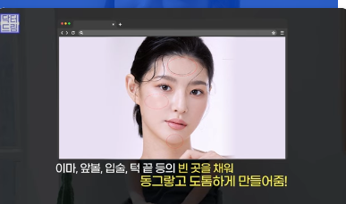 [강남역 성형외과] 이거 모르면 보톡스, 필러 맞았다가 후회합니다 사진 32