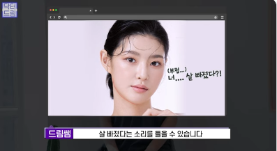 [강남역 성형외과] 이거 모르면 보톡스, 필러 맞았다가 후회합니다 사진 12