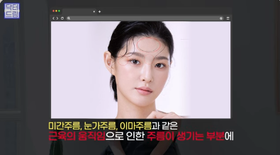 [강남역 성형외과] 이거 모르면 보톡스, 필러 맞았다가 후회합니다 사진 7