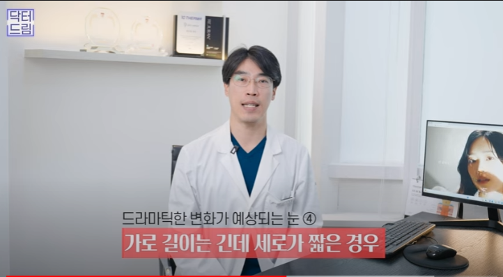 쌍꺼풀하면 대박나는 4가지 유형 사진 26