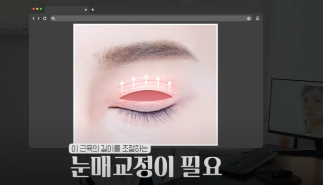 쌍꺼풀하면 대박나는 4가지 유형 사진 20